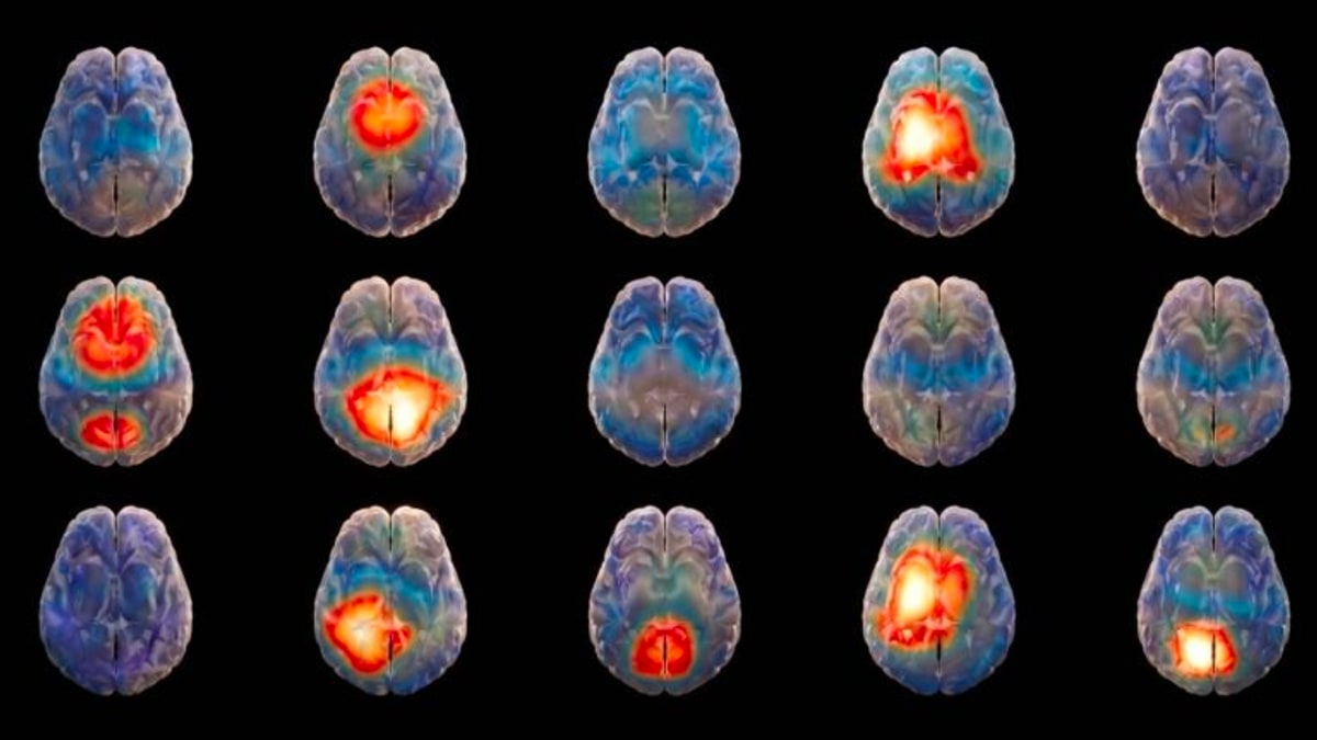Hemispheric's AI System Diagnoses Brain Disorders in 15 Minutes